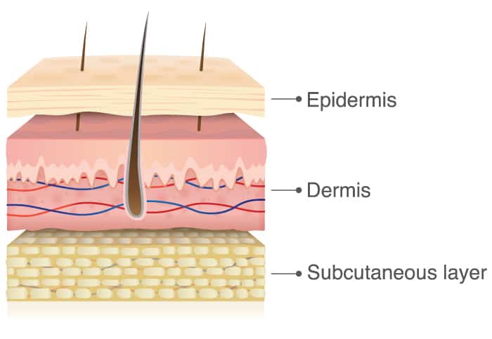 Diagram of clos up cross section of human skin with legend pointin got the three layes of the skin . Epidermis, Dermis, Subcutaneous layer